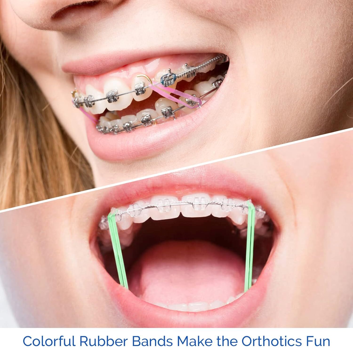 Dental Orthodontic Intra oral Elastic Neon Rubber Bands Elastics Brace Non-latex