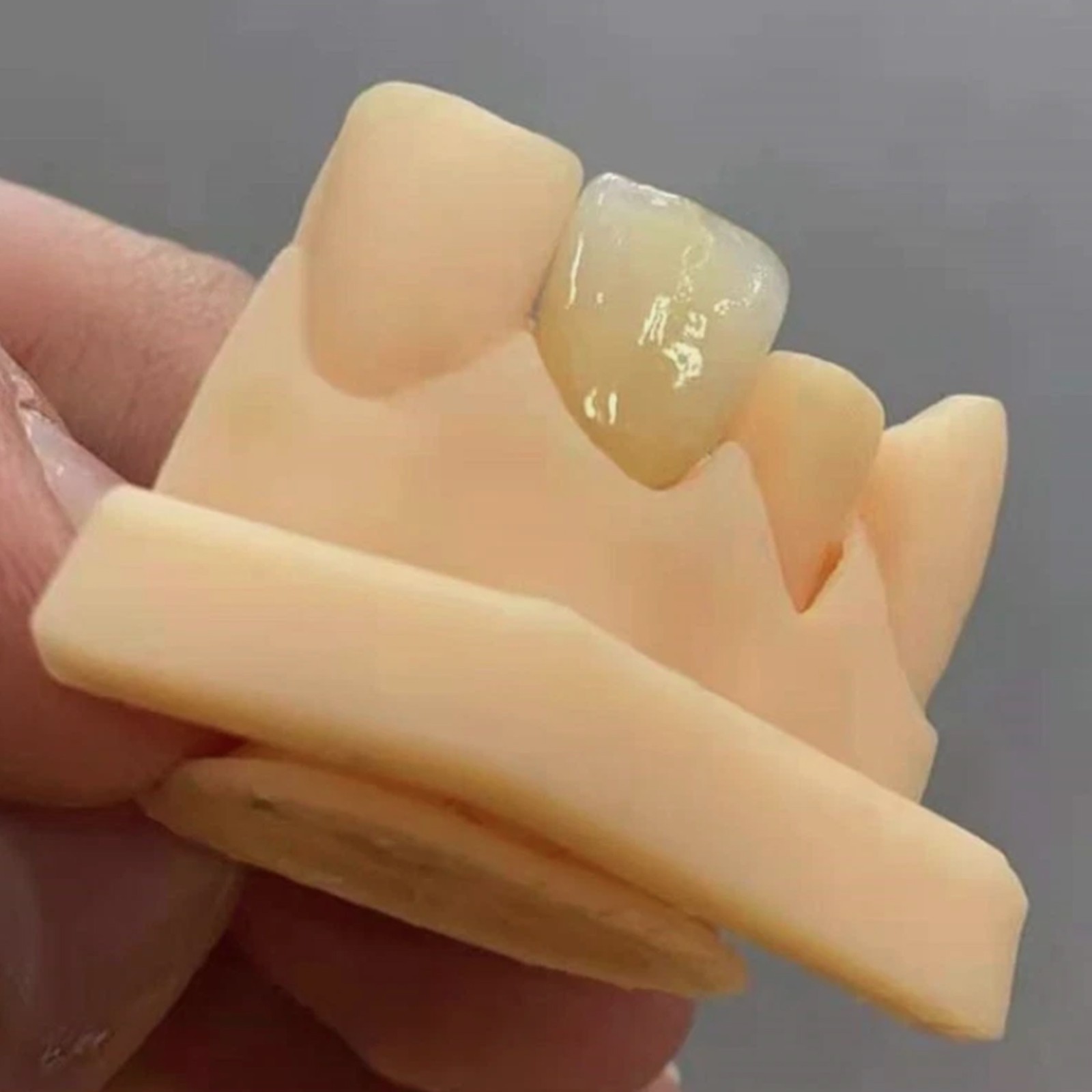 US 5PCS C14 LT Dental Glass Ceramic Lithium Disilicate Blocks Emax CAD/CAM