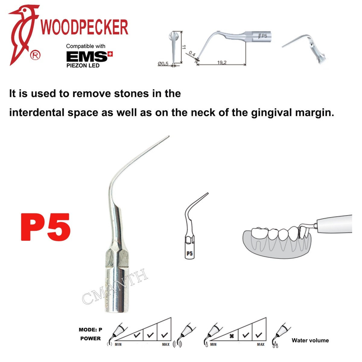 Woodpecker Dental Ultrasonic Scaler Tips P1-P33 Period Tips Fit EMS Scaler