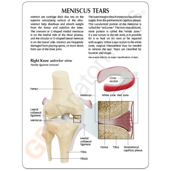 Knee Joint GPI Anatomical Model Meniscus Tears LFA#1010 Make Us An Offer! VIDEO