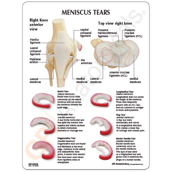Knee Joint GPI Anatomical Model Meniscus Tears LFA#1010 Make Us An Offer! VIDEO