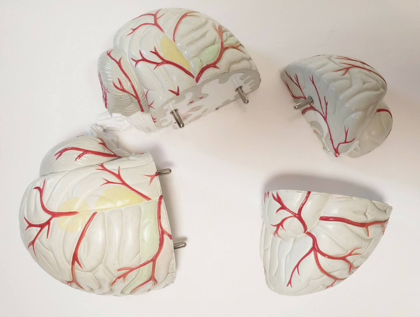 Human Brain Anatomical Teaching Model Life Size Medical Science Cross 4 Sections