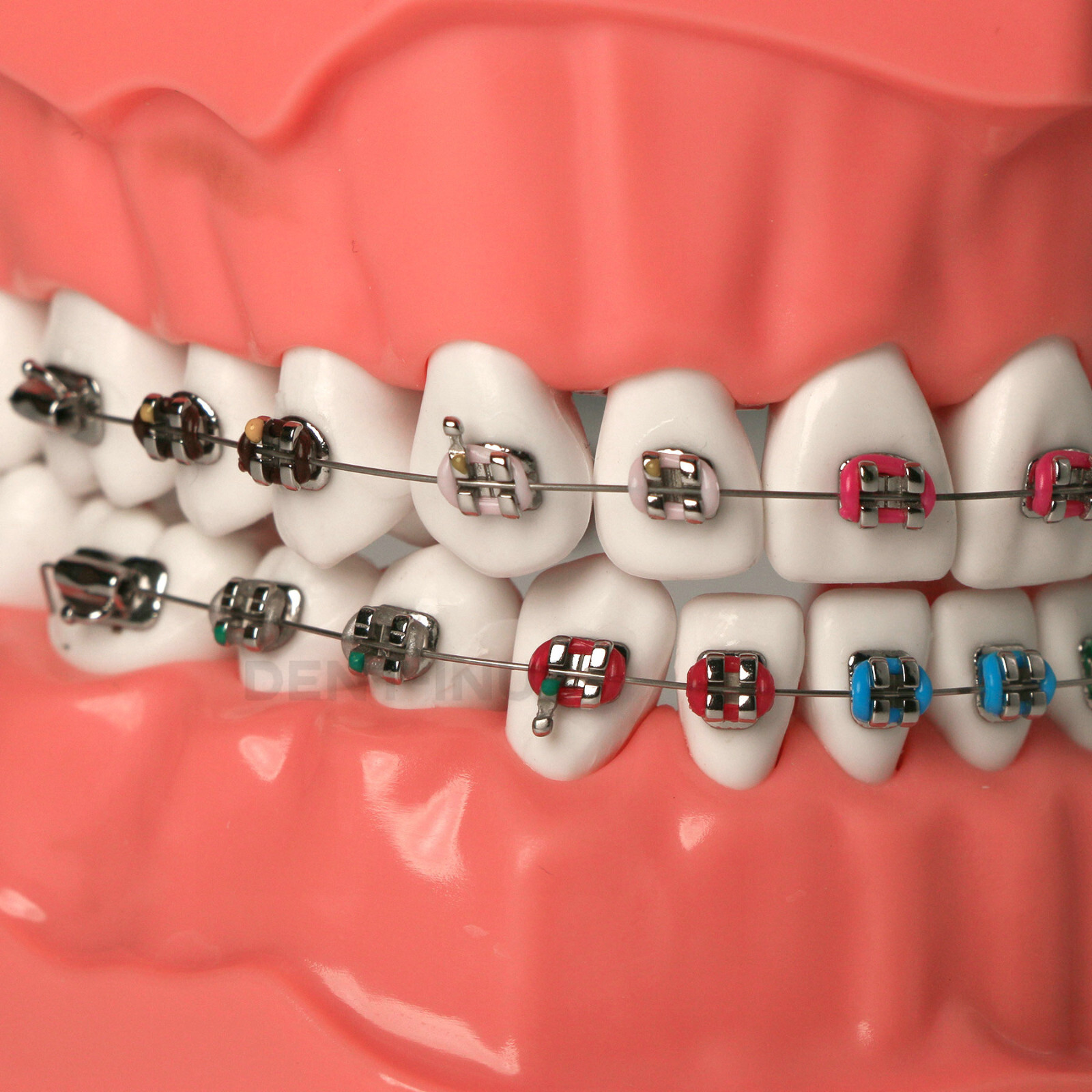 US Dental 1:1 TypodontTeeth Model Orthodontic with Metal Brackets Brace M7010-2