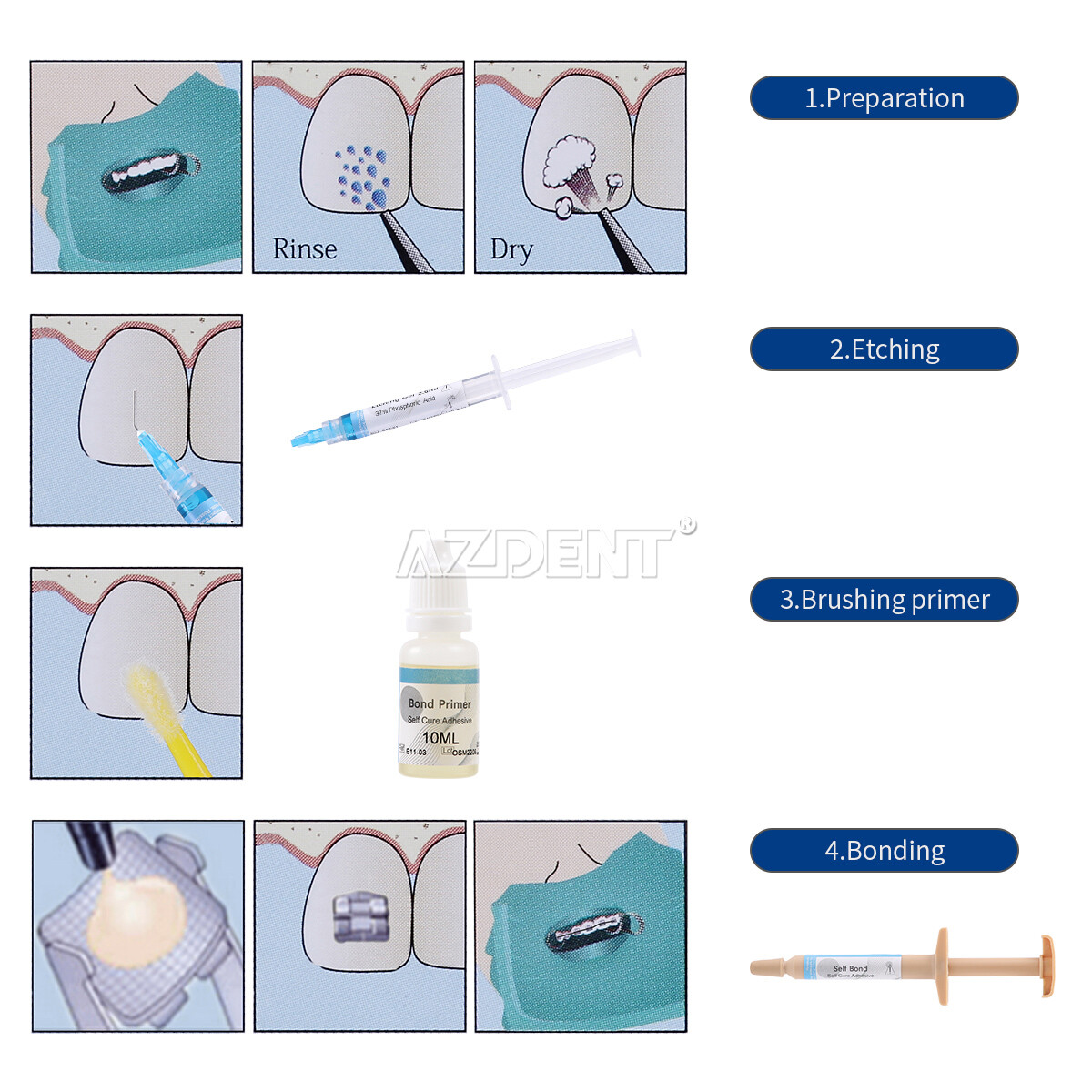 Dental Orthodontic No-Mix Direct Bonding System Adhesive Primer Resin