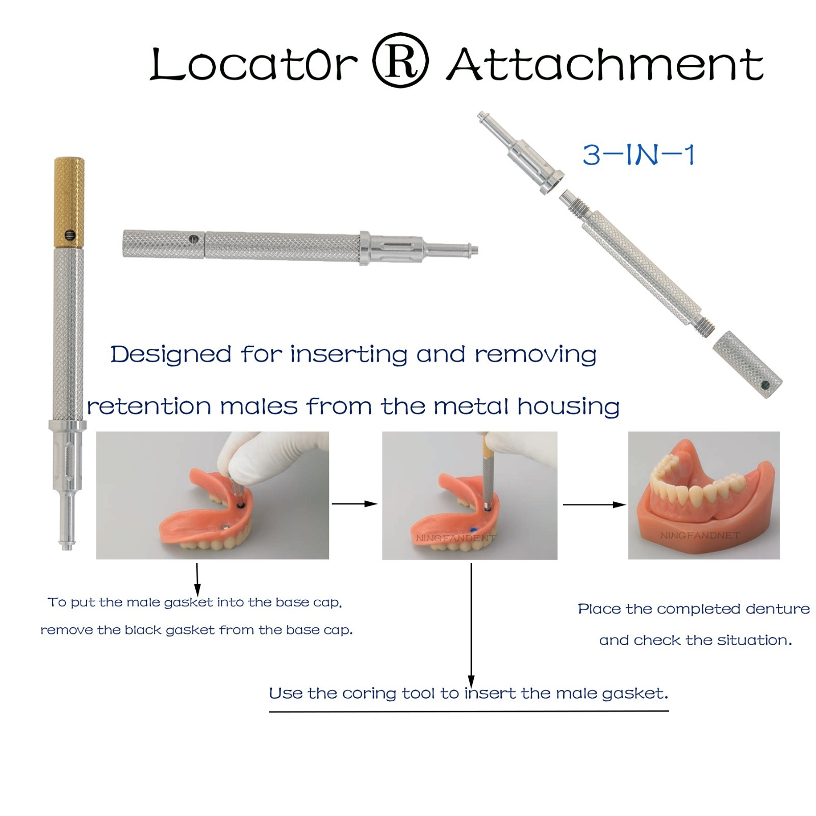 Overdenture Locator Abutment Male caps Inserts Tool for NEODENT GRAND MORSE GM