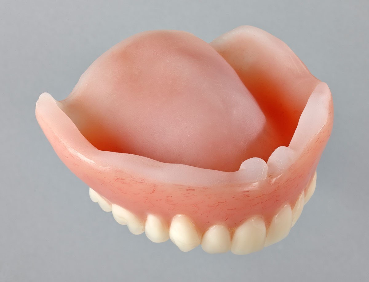 Maarc Soft Denture Reline Material for Temporary Re-Basing Acrylic Dentures