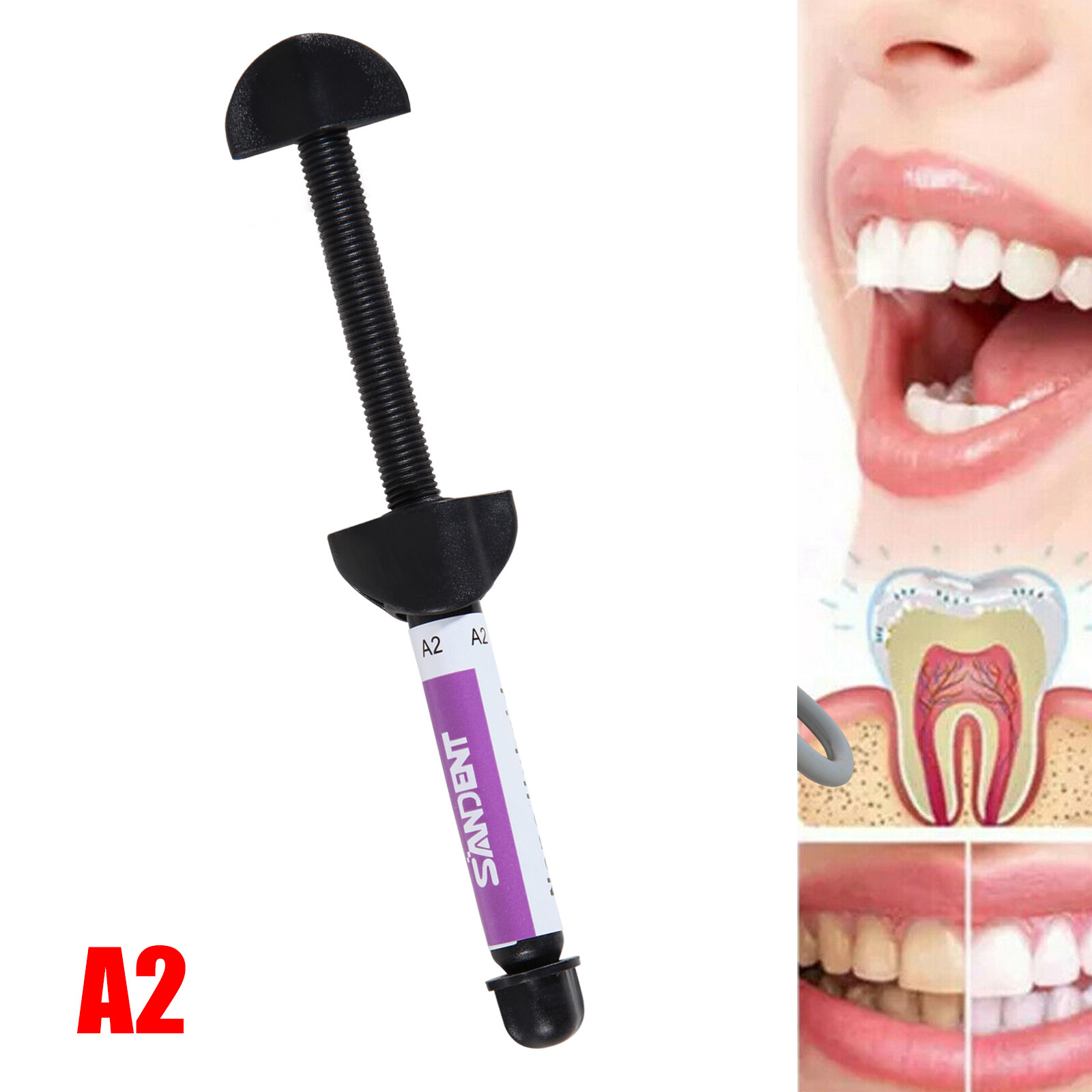 SANDENT Light Cure Hybrid Composite Dental Resin – 4.5 g 001-001 A2 Cure NEW H