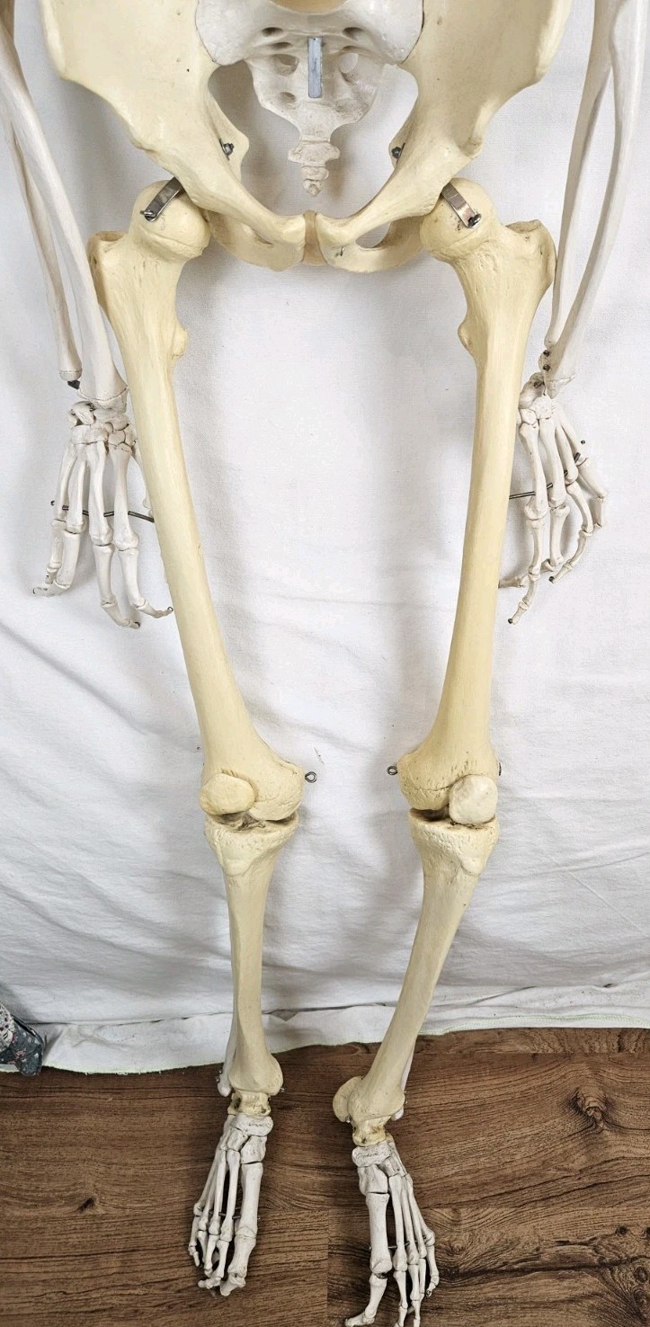 3B Scientific 5′ 6″ Human Skeleton Stan Hanging Model NO MANDIBLE