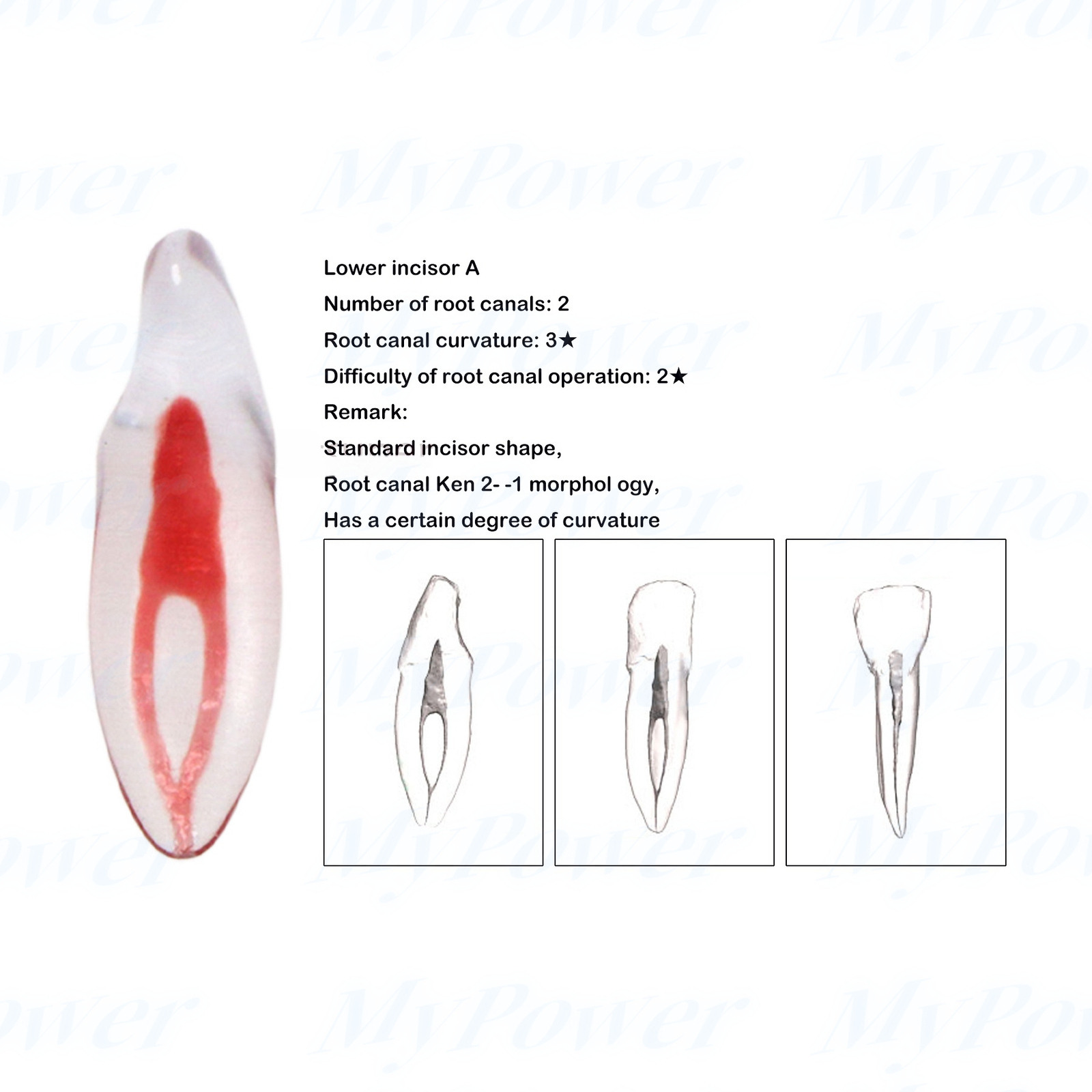Dental Training 3D RCT Endo Tooth Model Practice Model Curved Root Resin Teeth