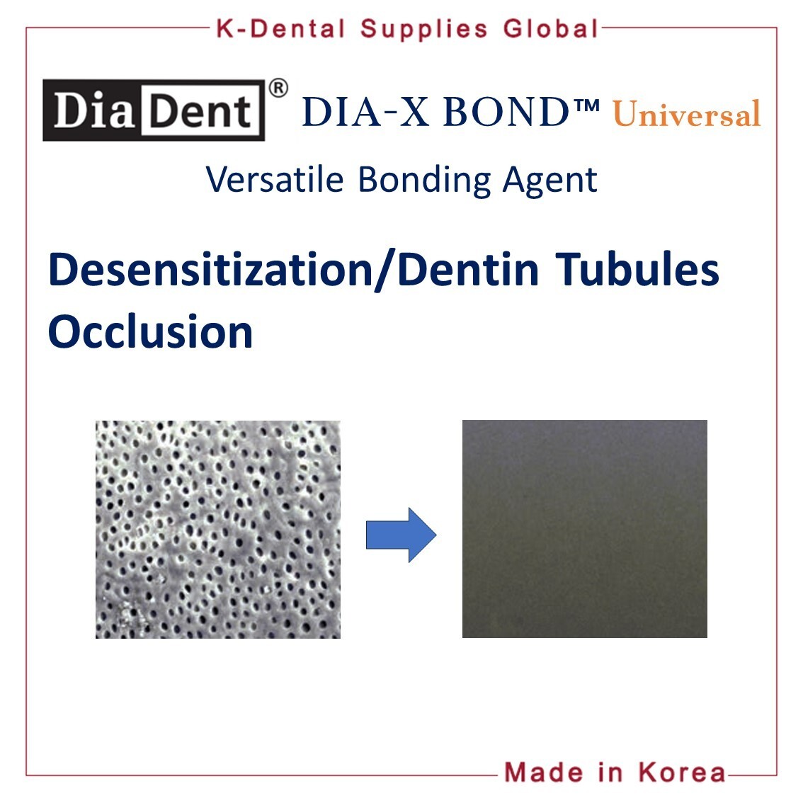 Diadent Dia-X Bond Universal Versatile Dental Bonding Agent 5ml