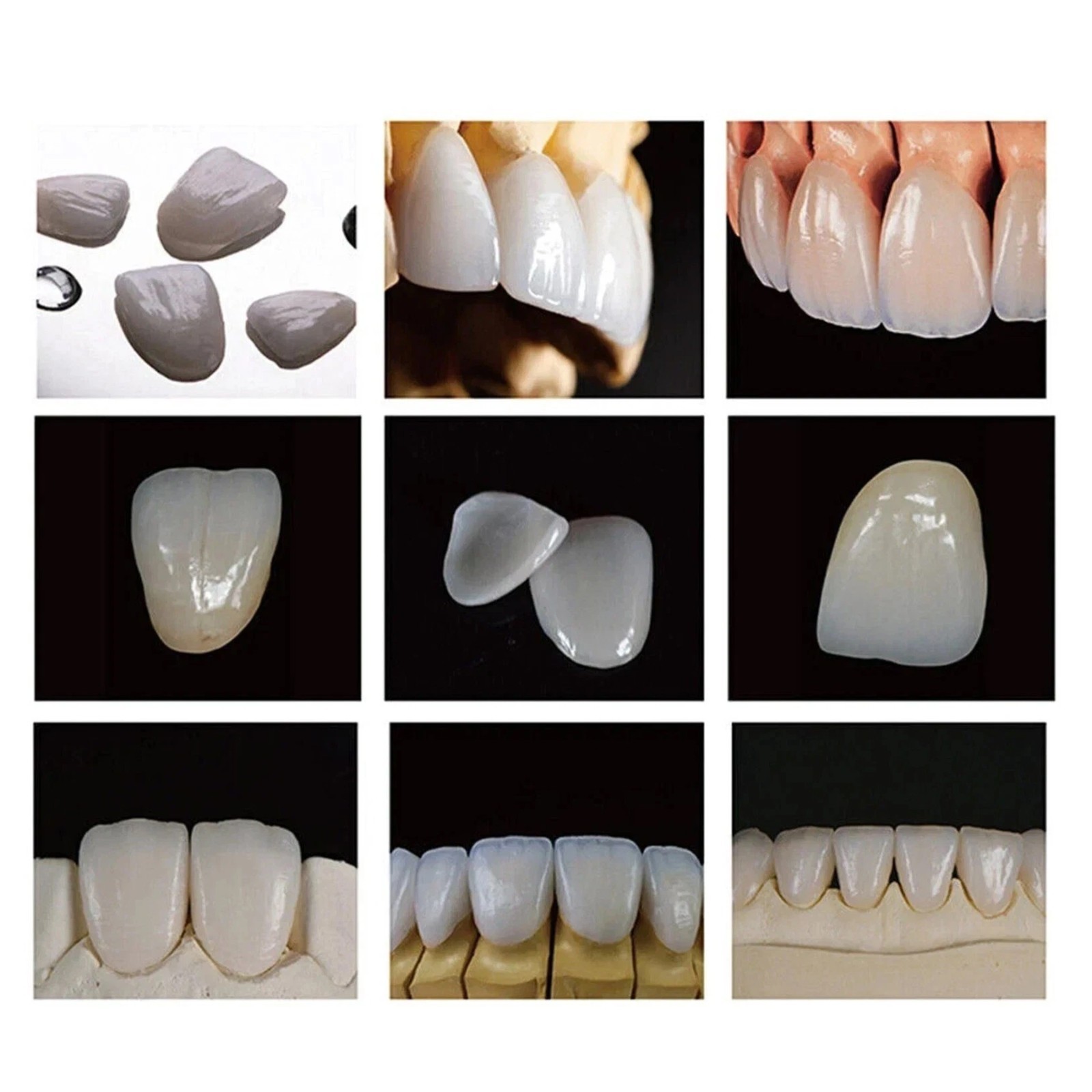 C14 Dental Emax CAD/CAM CEREC Ceramic Blocks Lithium Disilicate Block – 5pcs/Box