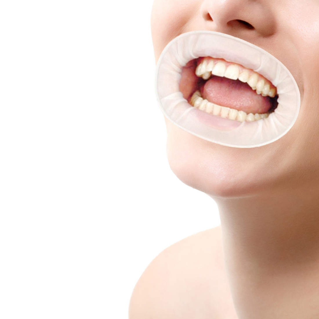 10Pcs Disposable Dental Mouth Opener Sterile Rubber Dam Cheek Retractor O Shape