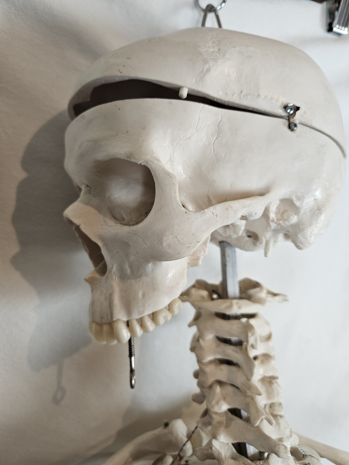 3B Scientific 5′ 6″ Human Skeleton Stan Hanging Model NO MANDIBLE