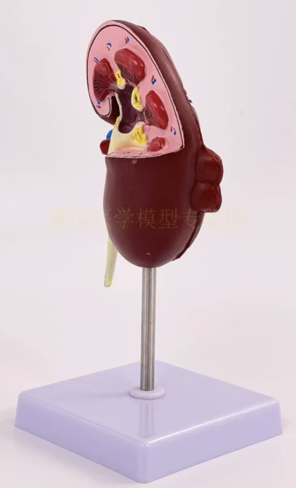 NEW Human Normal/Pathological Kidney Model Anatomy Medical Teaching Model