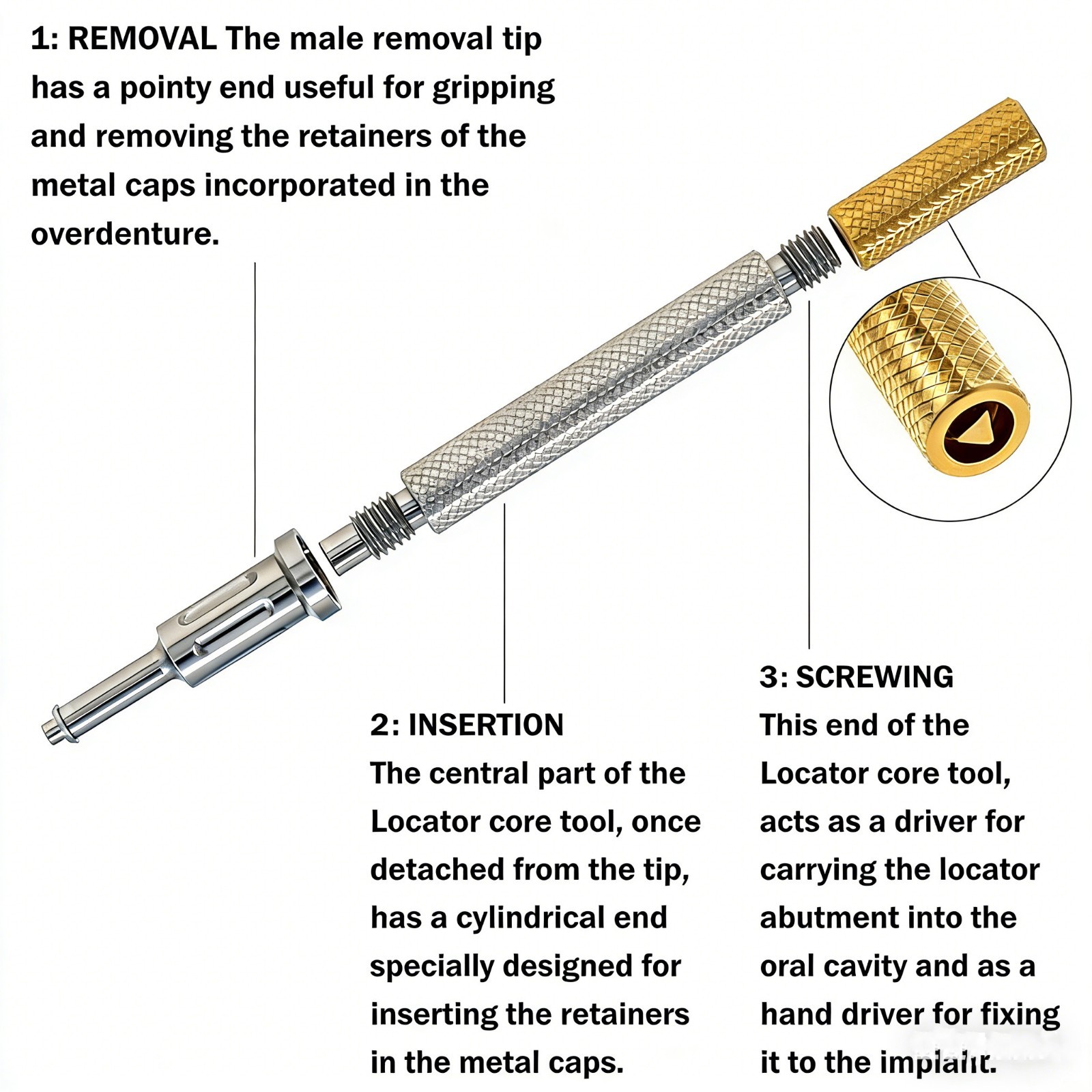 Dental Zest Locator Classic Core Tool for Legacy Locators 3‑in‑1 Abutment Driver