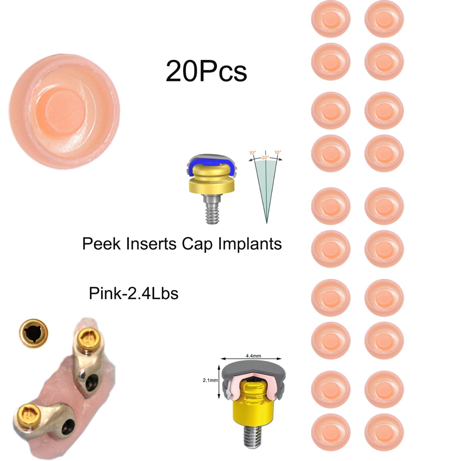 Dental Locator Classic Pink Standard Male Insert 2.4 lbs Light Retention Cap Set