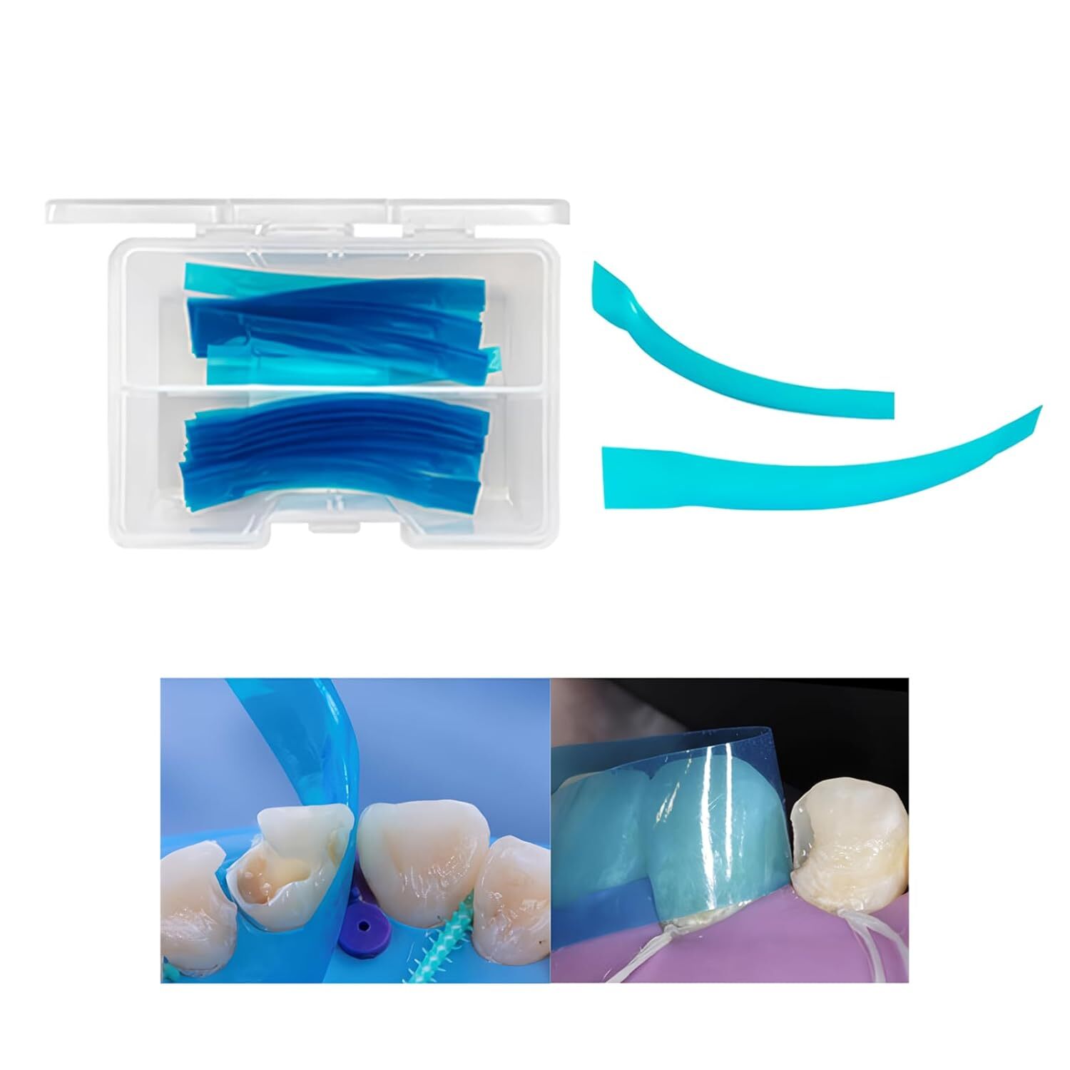 Dental Contoured Anterior Matrix Bands Polyester Anterior Strips Matrices System
