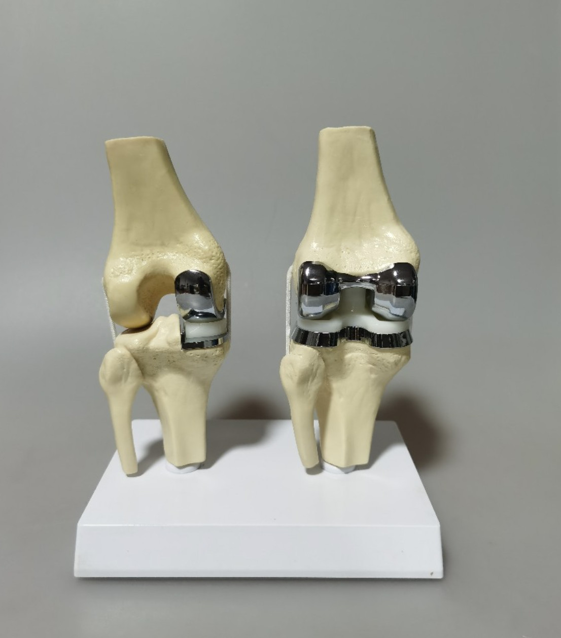 Artificial Shoulder Replacement Anatomical Model Knee Shoulder Elbow Joint Model