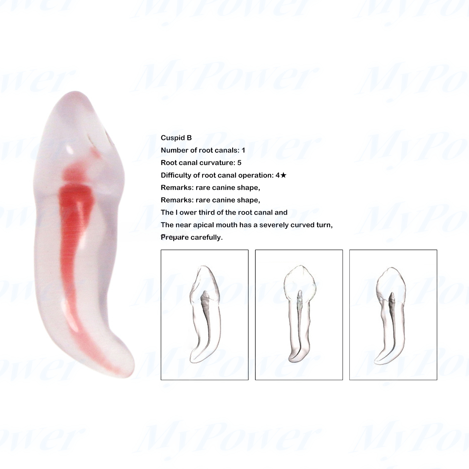 Dental Training 3D RCT Endo Tooth Model Practice Model Curved Root Resin Teeth