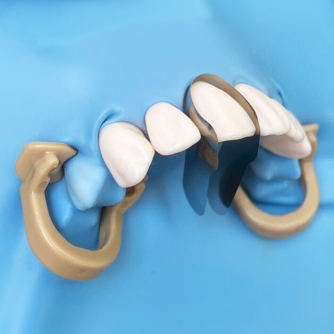 Dental Contoured Anterior Matrix Stainless Steel Twin Matrices/Resin Blue Strip