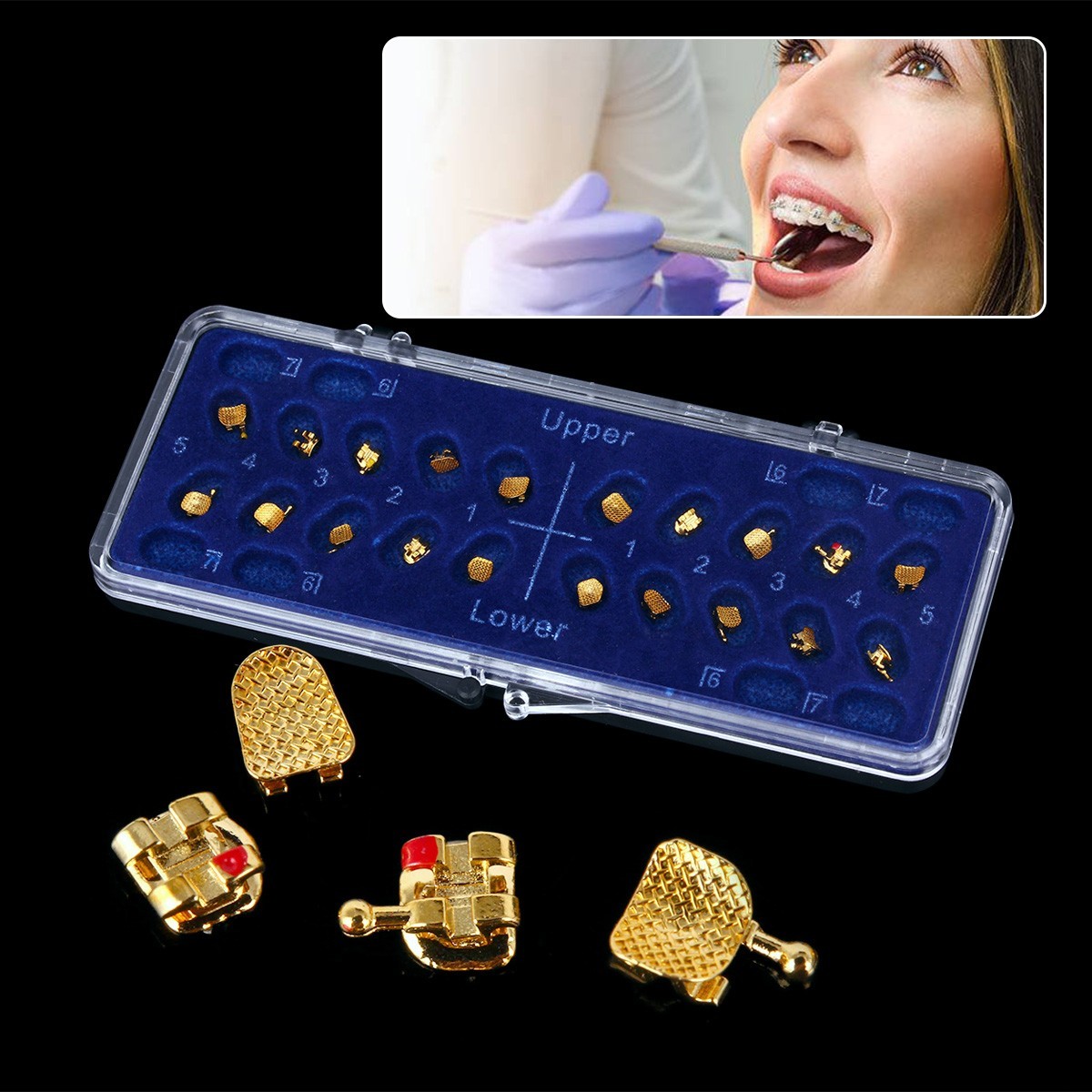 Dental Orthodontic Gold Brackets Mini Roth 022 Hooks 345 Brace AZDENT