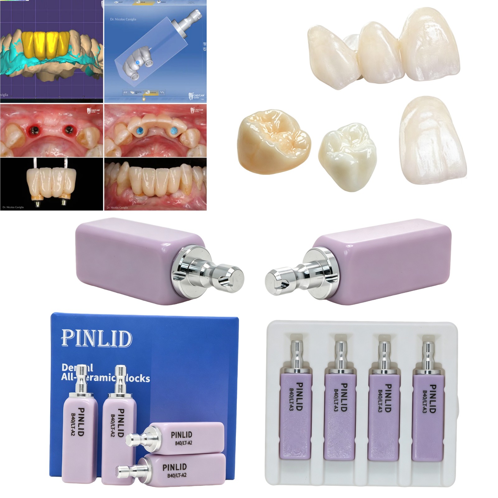 LT Dental Glass Ceramic CEREC CAD CAM B40 Blocks Bridges Lithium Disilicate 4Pcs