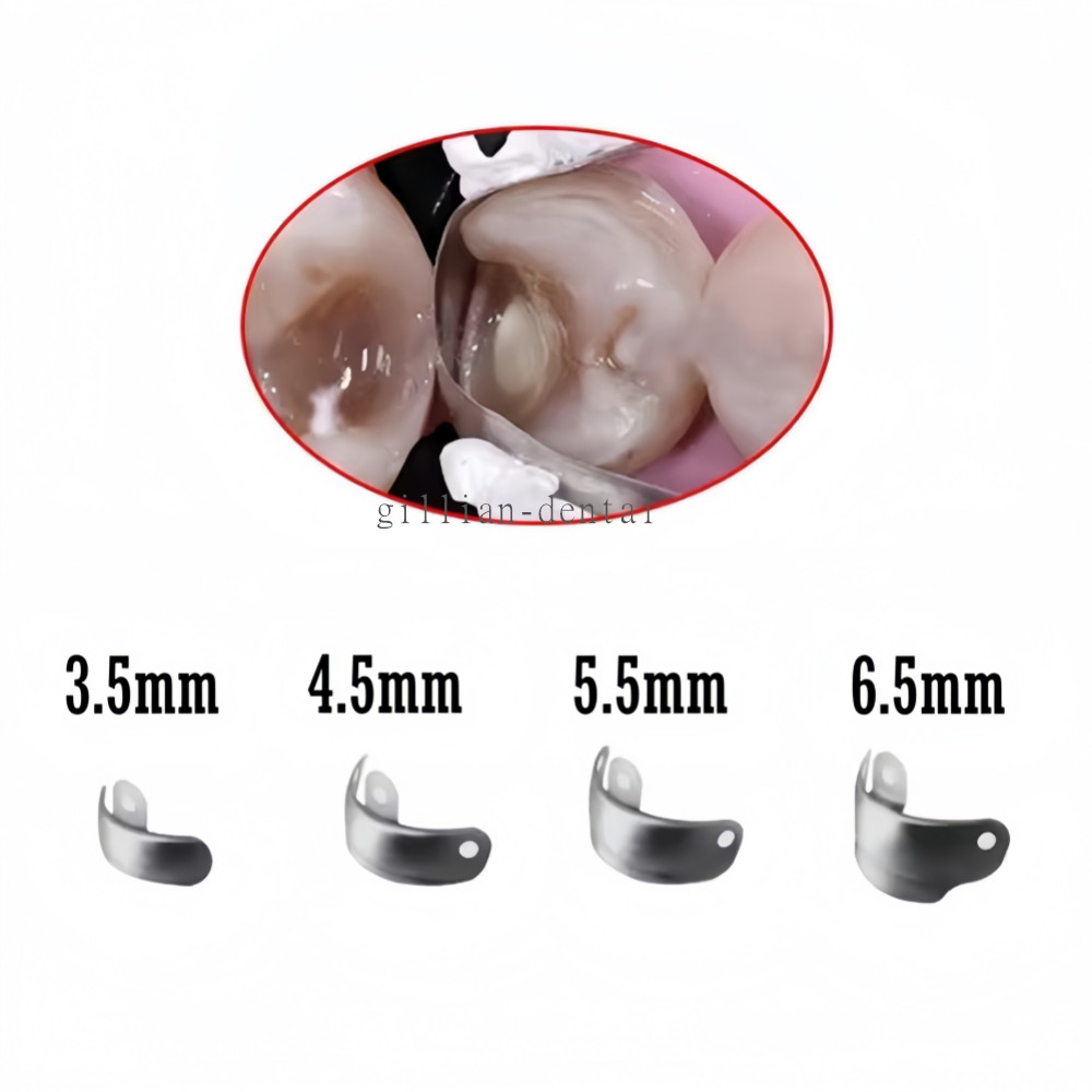 50PCS Dental Matrix Band M4 Metal Sectional Sectional Contoured Matrices Refill