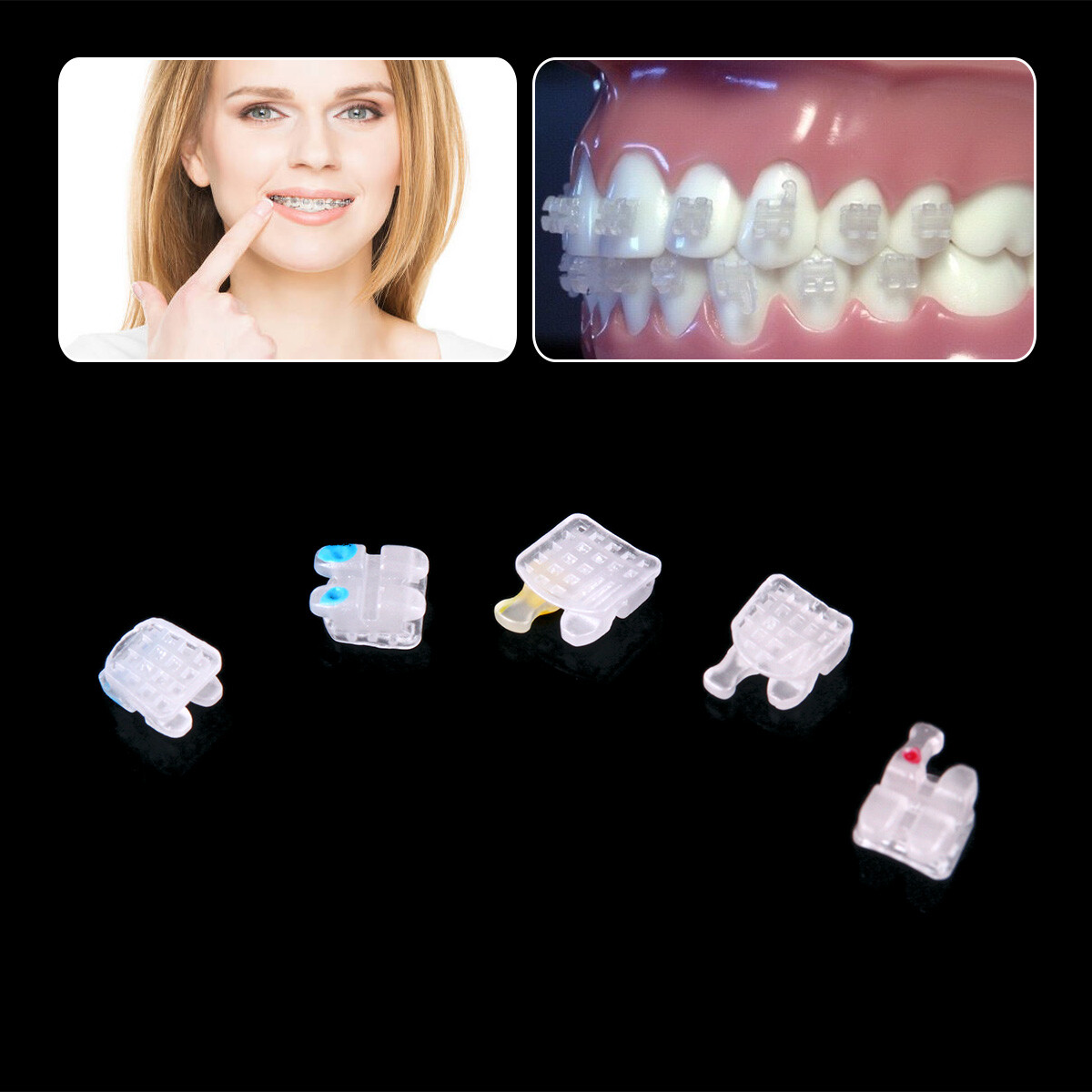 AZDENT Dental Ceramic Bracket Braces MBT/Roth.022/018 Hooks 3 4 5 20pcs/Kit