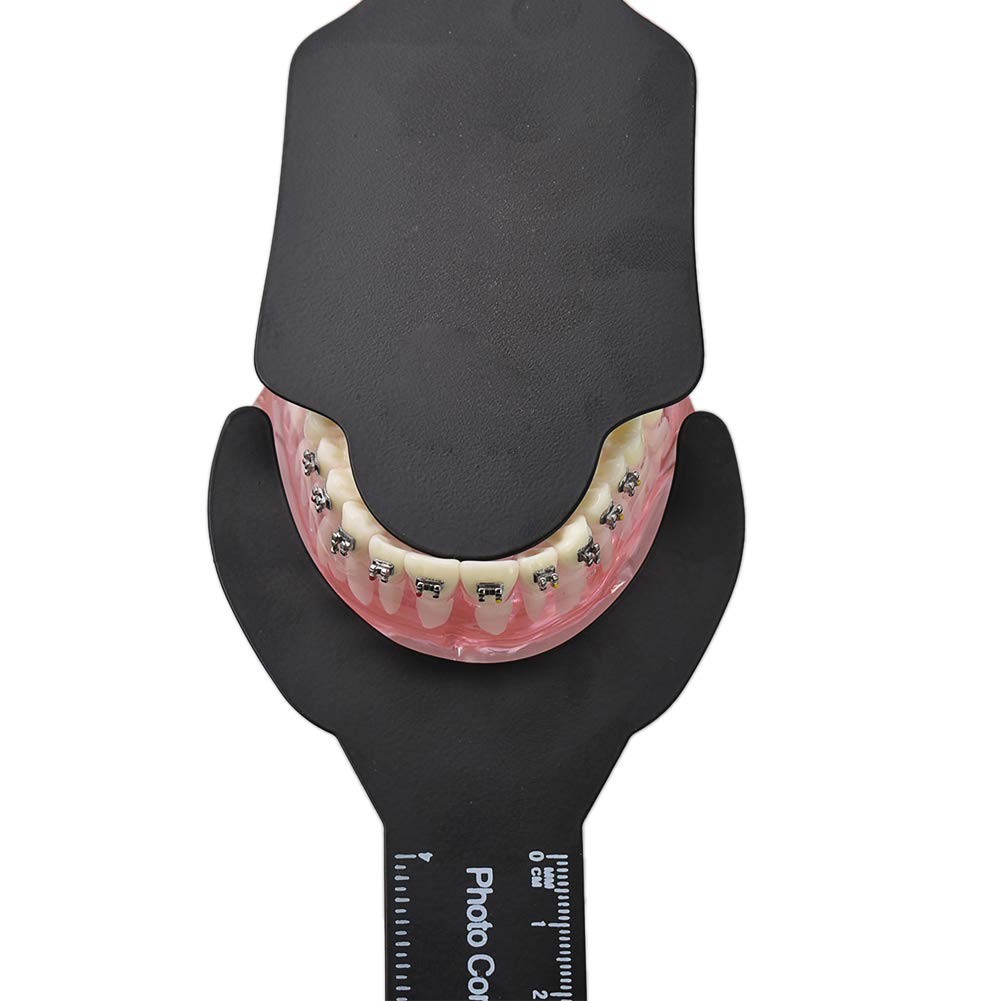 Angzhili 6 Pcs Dental Contraster Intraoral 6 Piece Assortment, black