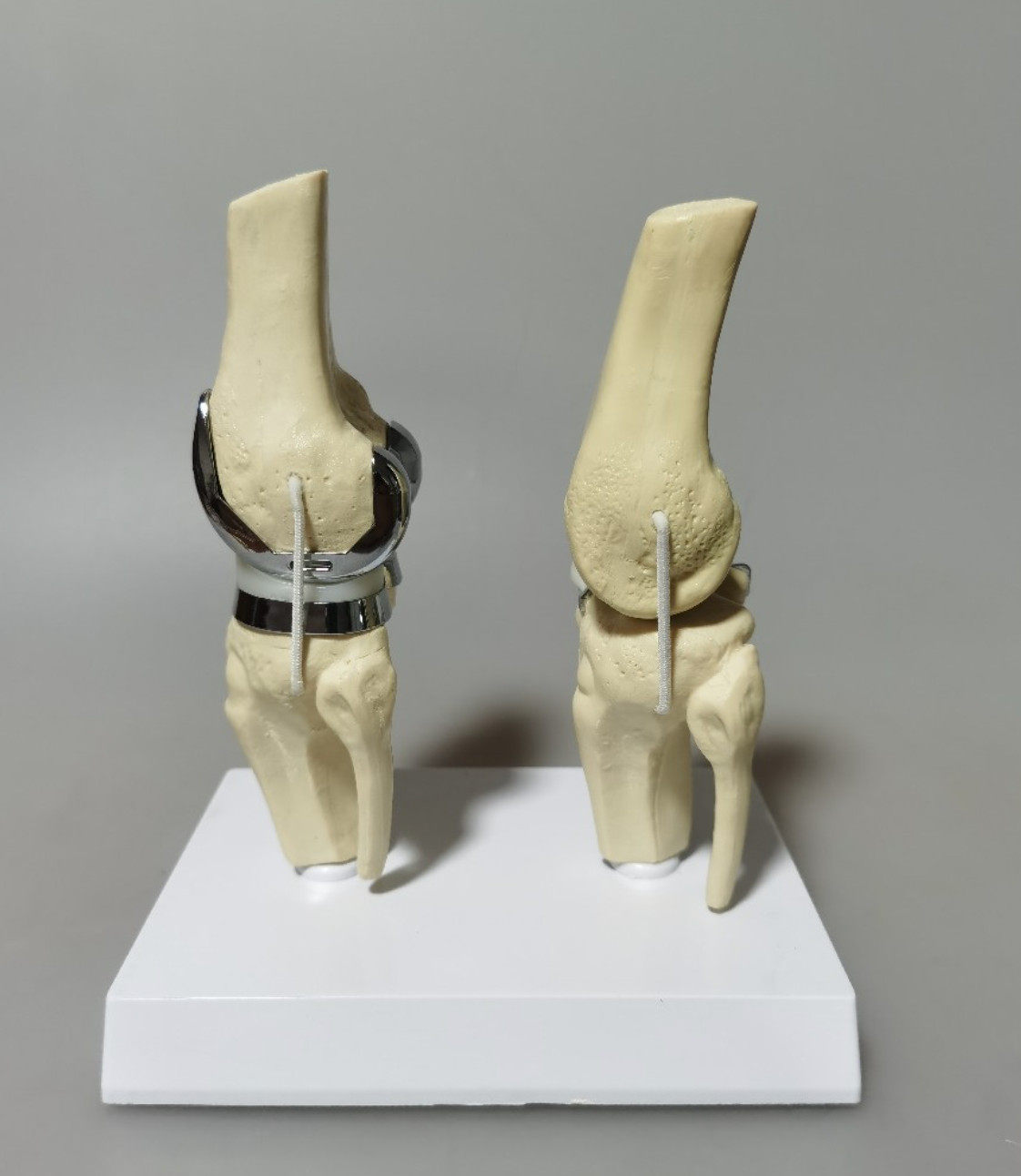 Artificial Shoulder Replacement Anatomical Model Knee Shoulder Elbow Joint Model