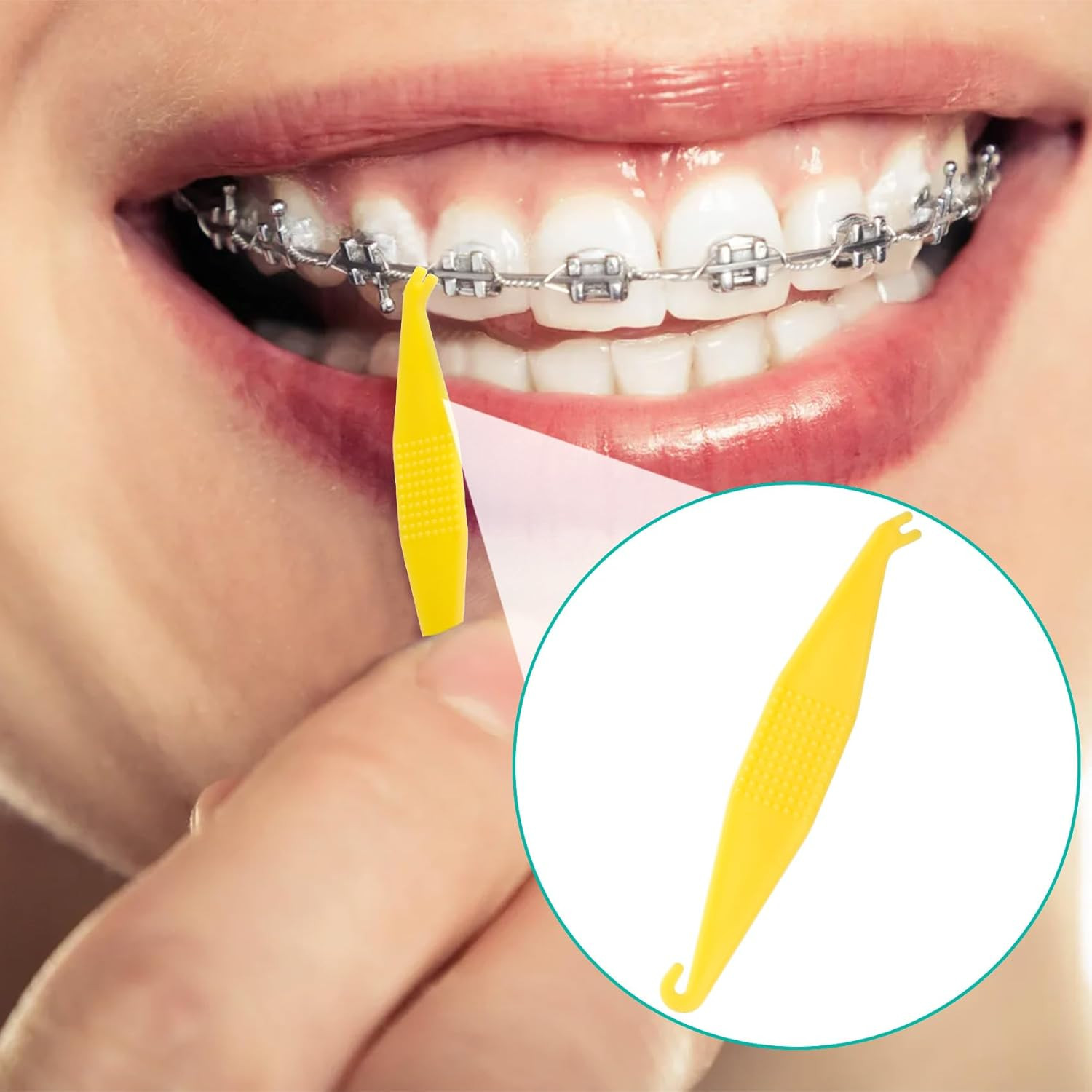 50Pcs Orthodontic Rubber Bands Tool for Braces, Colorful Elastic Dental Placer f