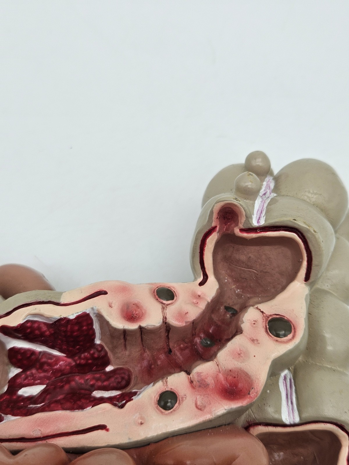 GI Tract Anatomy Model Handpainted Medical Display Gastro Intestinal Display