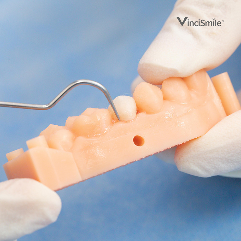 TopCEM-Veneer Dental Light Cure Veneer Cement 2.5g