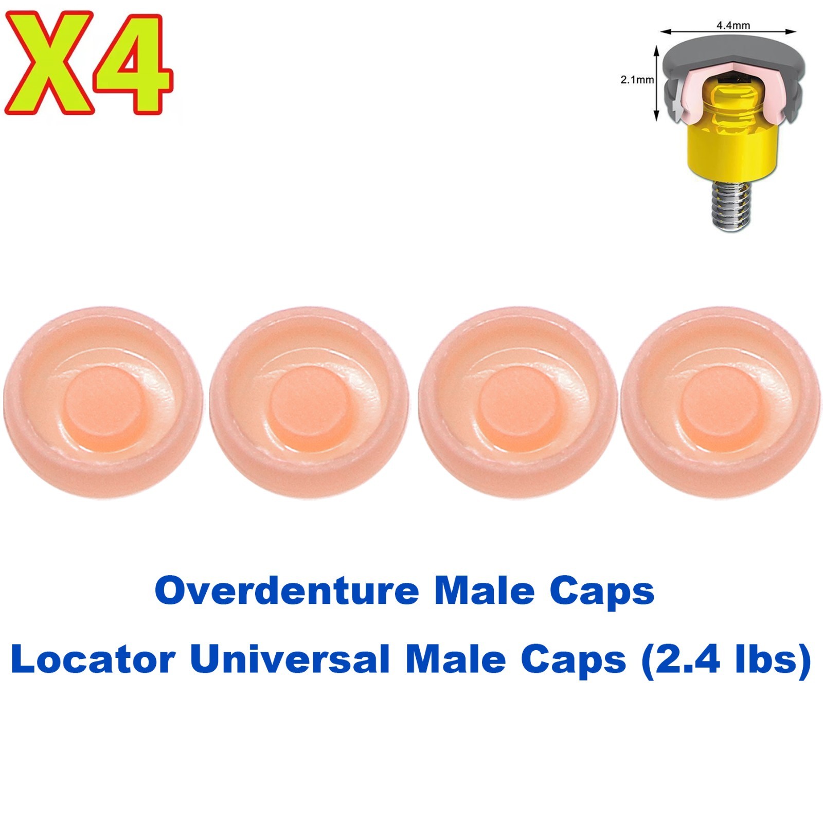 US 4Pcs Dental Implant Overdenture Retention Caps For Locator Abutment Insertion