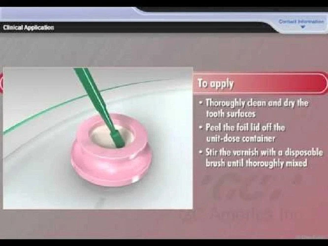 GC MI Varnish Sodium Fluoride Varnish RECALDENT 5 Single Units Strawberry Flavor