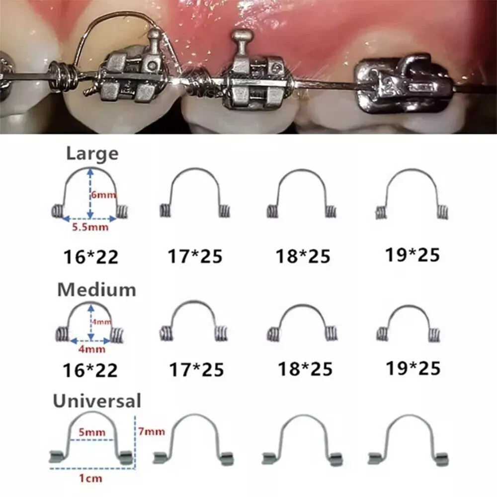 10 Pcs/bag Dental Orthodontic Anterior Torque Rectangular Torquing Spring L/M/S