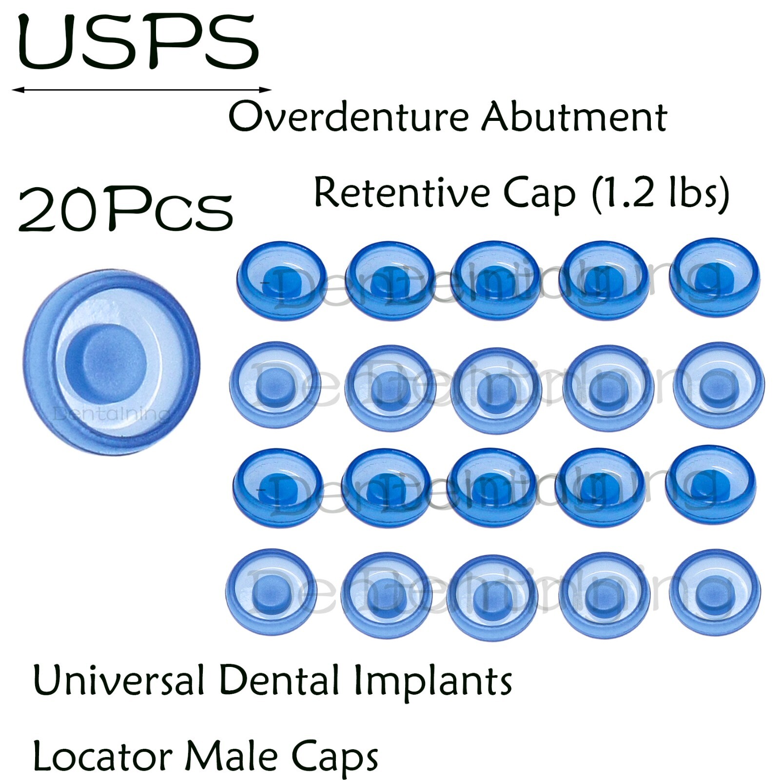 US Dental Universal Locator Male Caps Standard Xtra-Light, Blue 1.2lbs 20-pack