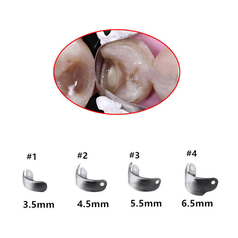Dental Sectional Matrix Refills Holder Clamp Matrices Bands Titanium Ring Clip