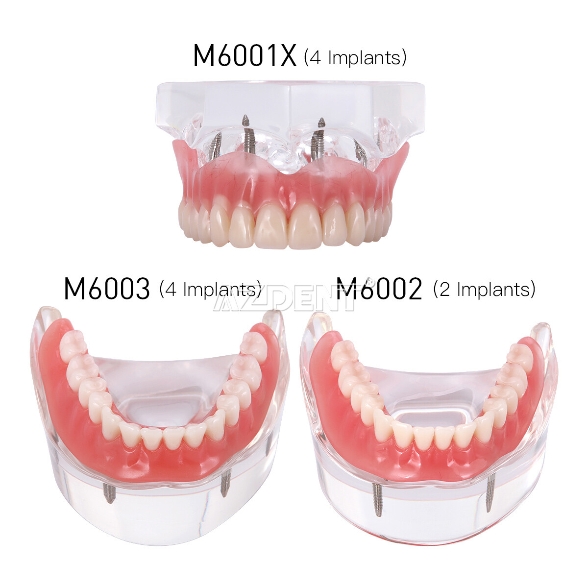 Implante dental Dientes Modelo Demo Sobredentadura Restauración 2/4 Implantes