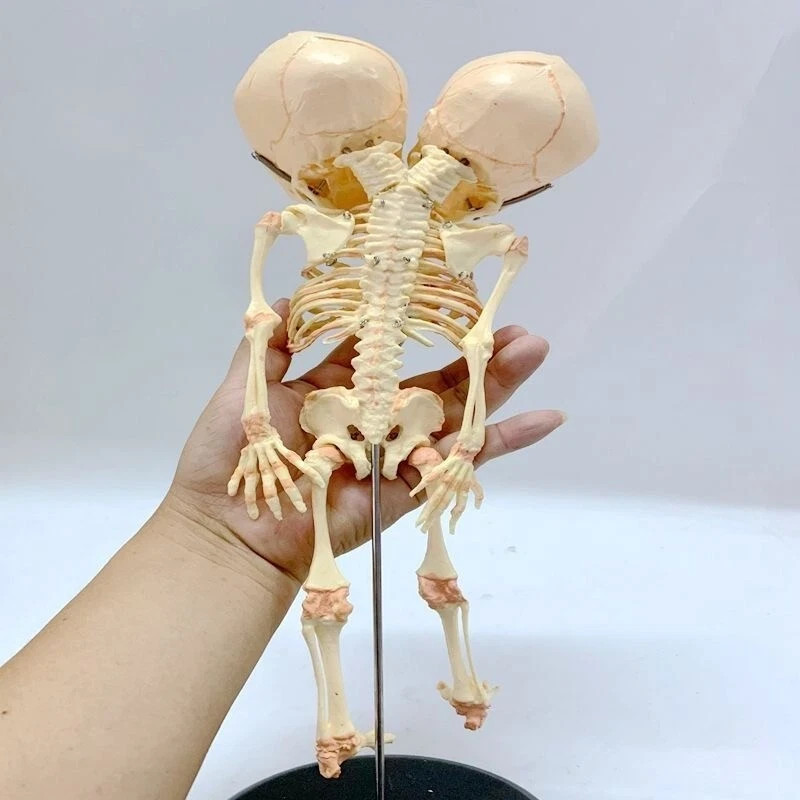 14″ Two-headed Baby Skeleton Model Fetal Model Teaching Newborn Skull Display