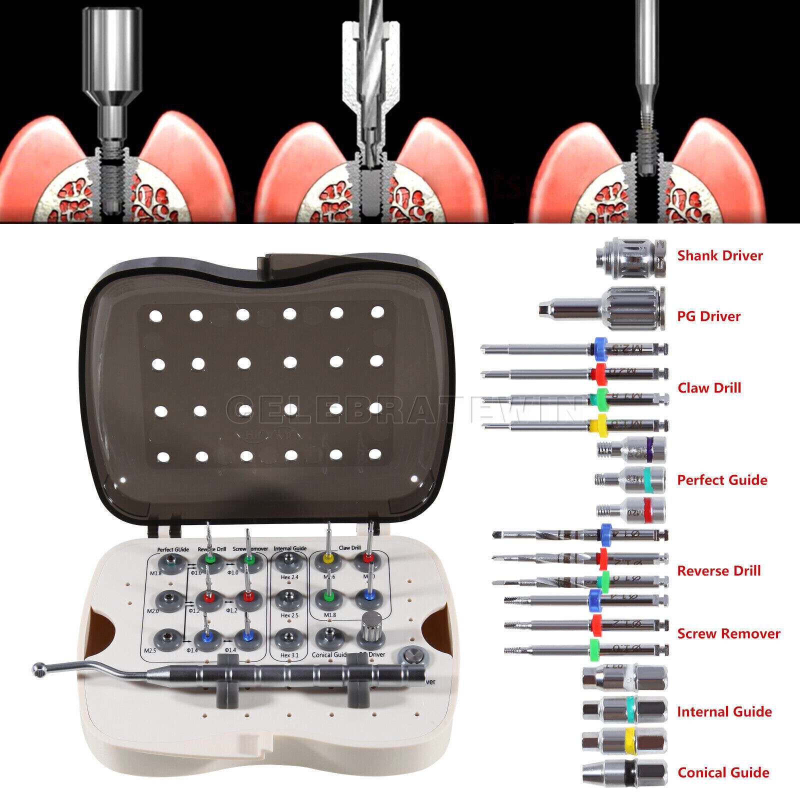 Dental Implant Fixture & Broken Screw Removal Kit Remove Surgical Tool Remover