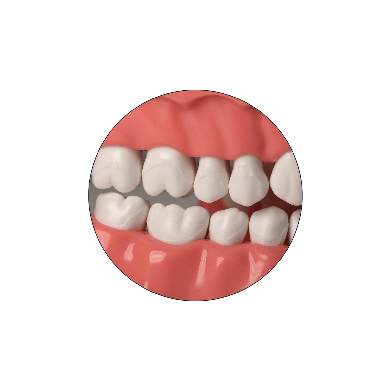 Dental Typodont Orthodontic Teeth Model with Metal Braces for Brushing Practice
