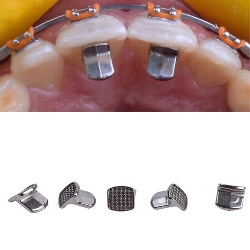 10Pcs/Bag Dental Orthodontic MIM Bite Opener Tongue Bite Tamers Turbos Wings