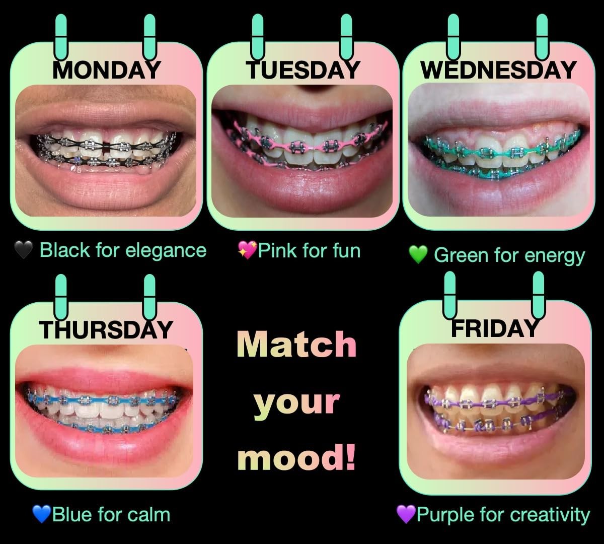 Braces Power Chains Short 5 Colors (Blue, Green, Pink, Purple, Multicolor