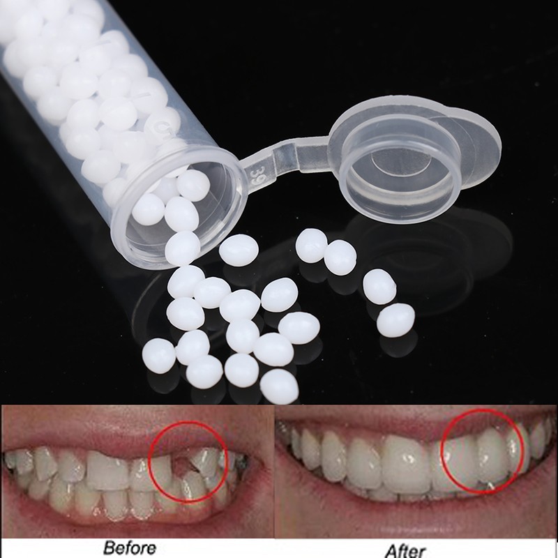 Temporary Tooth Repair Kit Teeth And Gaps False Teeth Solid Glue Dentu PfA7Uyt1