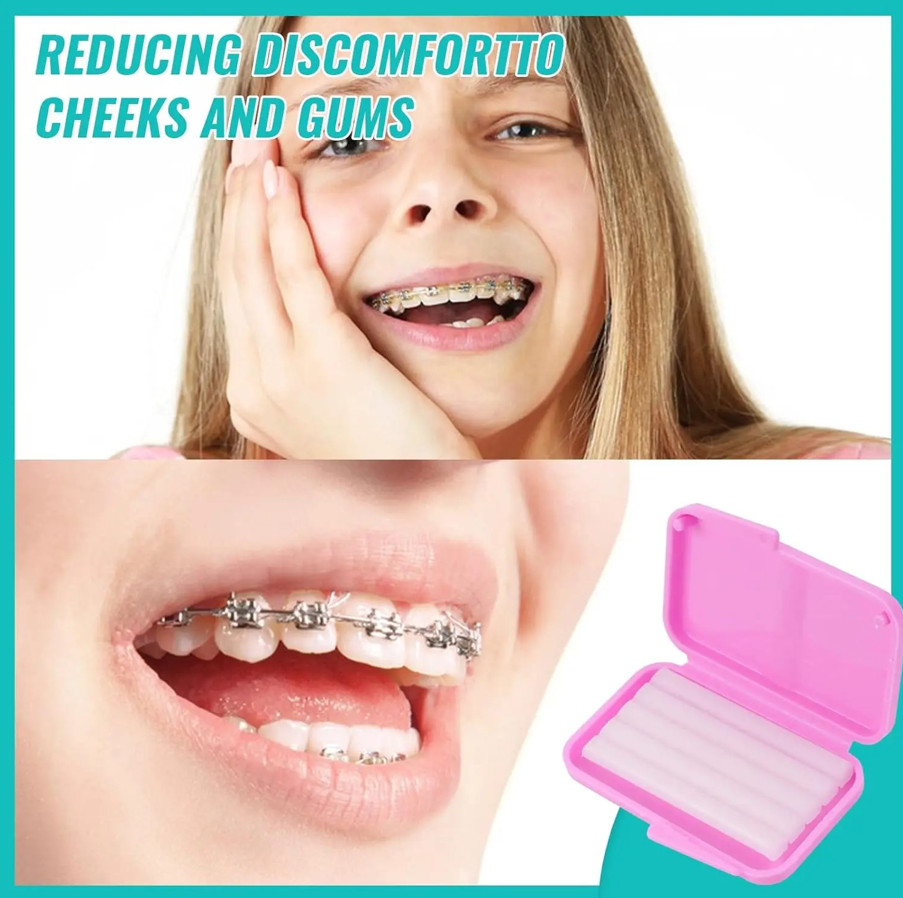 10Pcs Orthodontic Relief Wax Fruit Flavour Braces Wax Set Fruit Flavour Wax