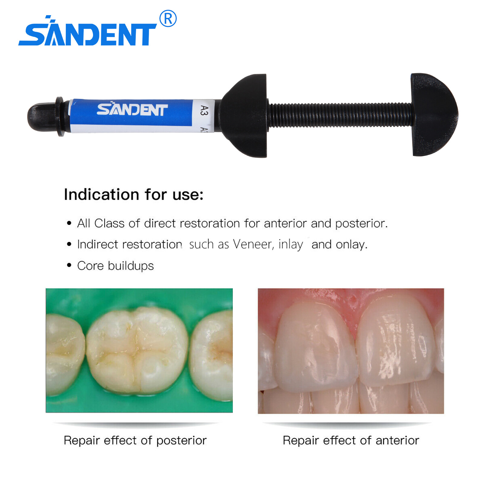 Dent Light Cure Hybrid Composite Dental Resin Shade A3 – 4.5 g syringe 001-001