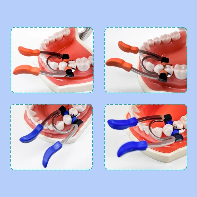 Dental Matrix Bands Ring Sectional Matrice Clamp Fit Garrison Palodent V3 System