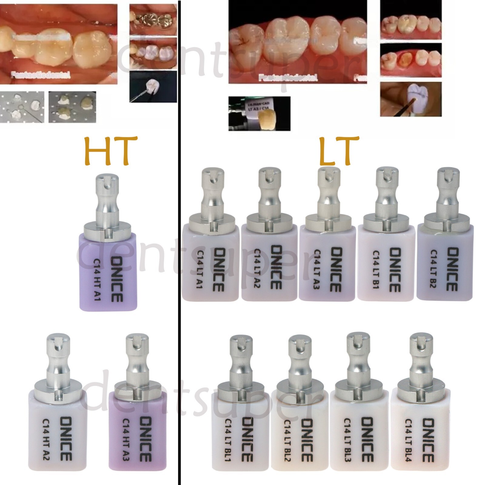 5Pcs/Box Dental LT HT C14 Glass Ceramic Lithium Dislicate Blocks Cerec CAD/CAM