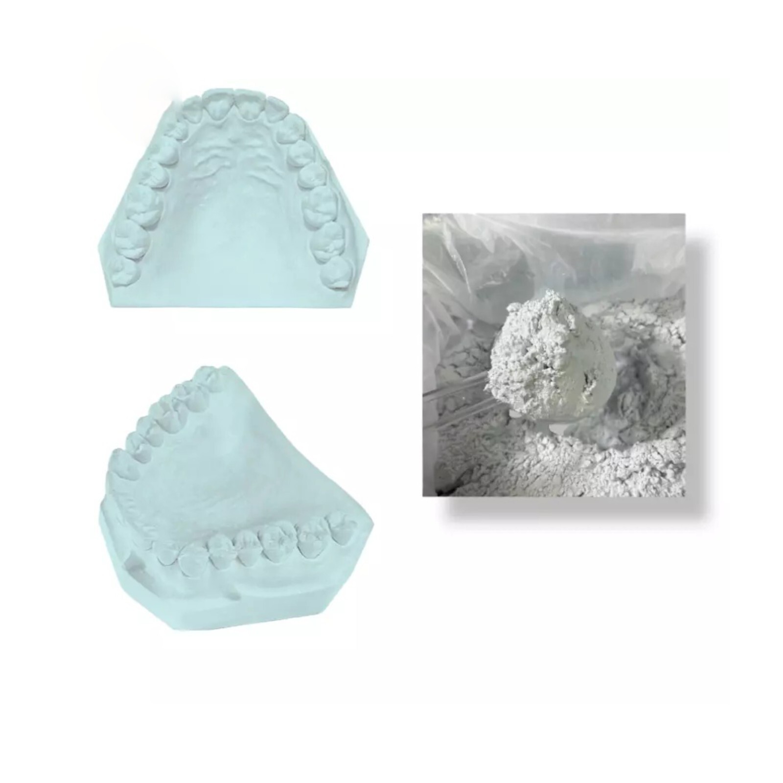DENTAL GYPSUM DIE STONE TYPE IV BLUE HIGH STRENGTH COMPOUND LOW EXPANSION 1 Lb.